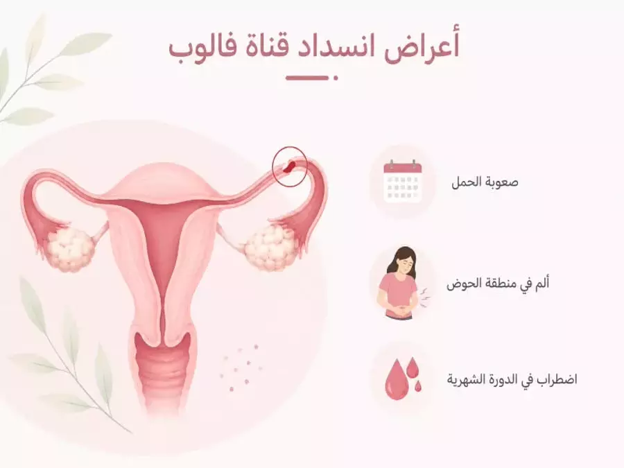 أعراض انسداد قناة فالوب 